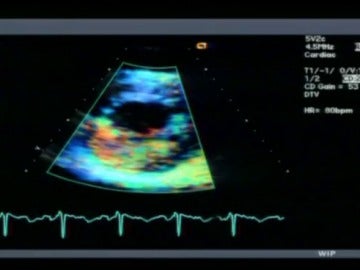 El electrocardiograma juvenil