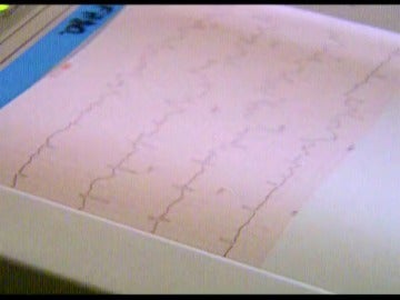 El reportaje, electrocardiograma infantil 