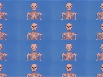 Si te escayolan Si te escayolan