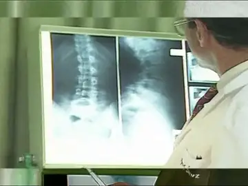 La radiografía La radiografía