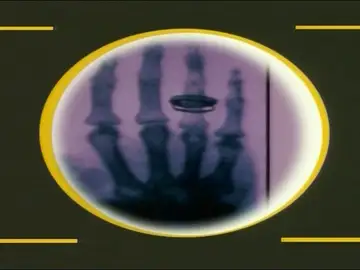 Fantásticos de la ciencia: Rayos X Fantásticos de la ciencia: Rayos X